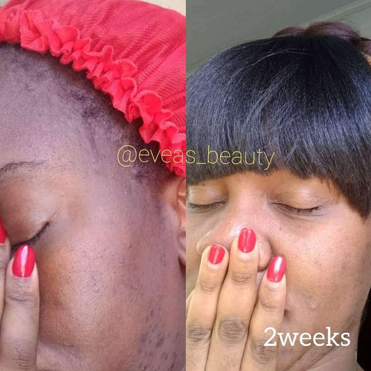 Organic, Natural for face Tranexamic Anti-aging Face cream